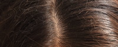 Why does my hair get greasy so fast? Understanding Why – Natural Spa ...