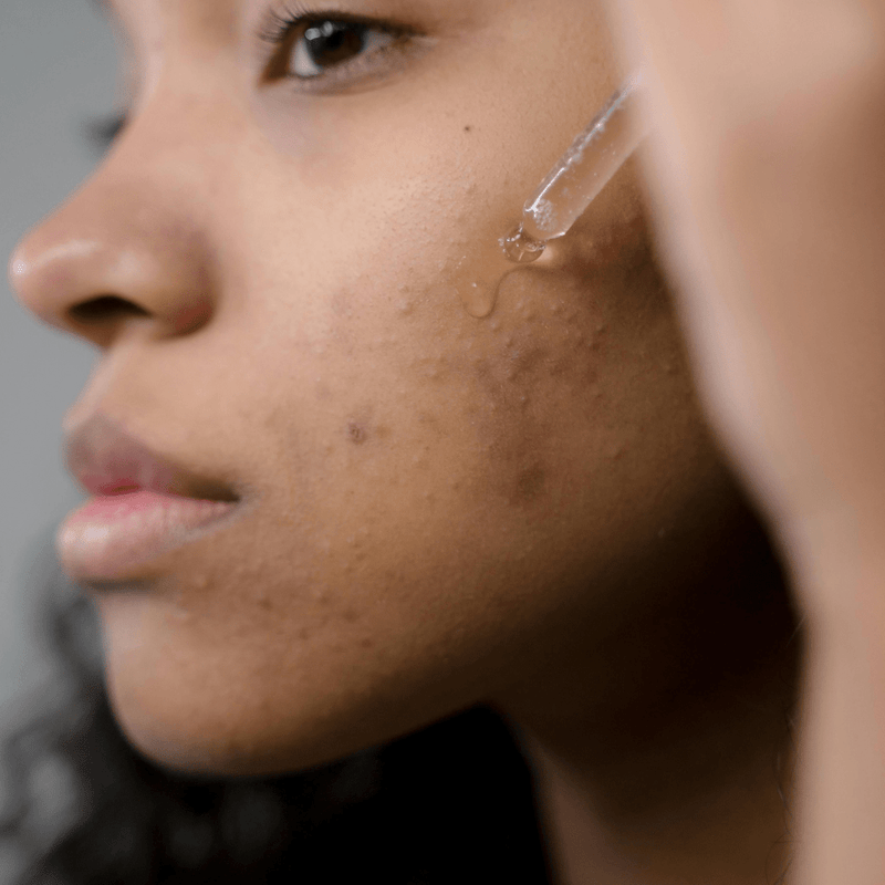 Nourishing Bakuchiol Facial Oil - Vegan Friendly, Suitable For All Skin Types